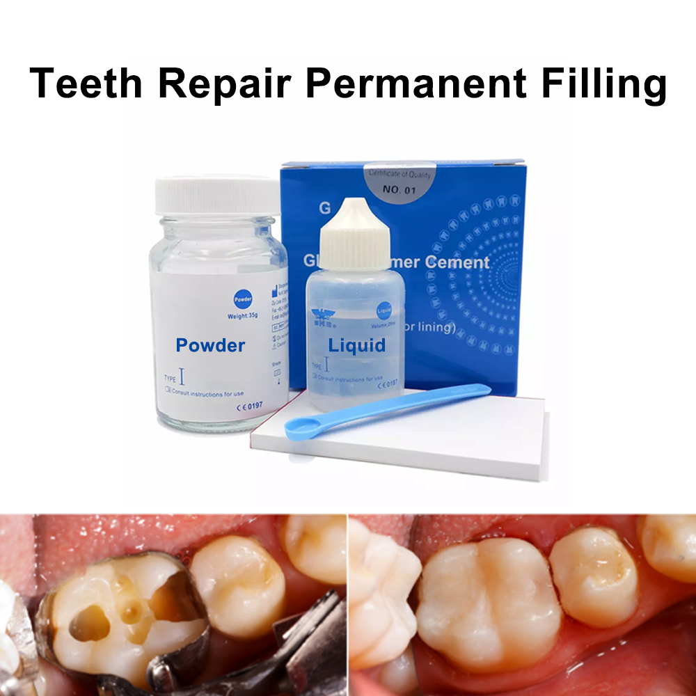 Teeth Whitening Kit At Home - Permanent Teeth Filling Repair Kit At