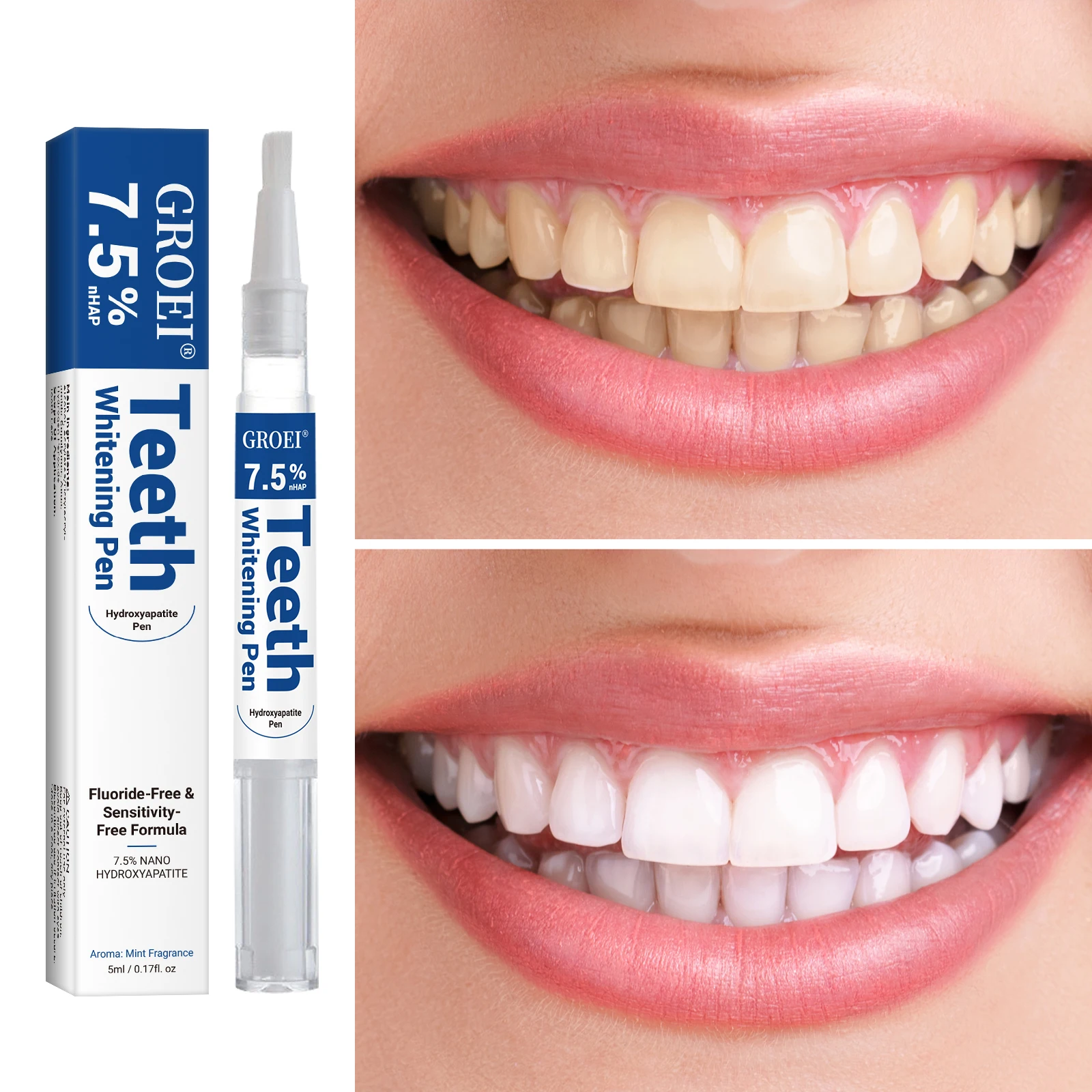Hydroxyapatite Tooth Whitening - огляд і ціна Teeth Whitening Before And After
