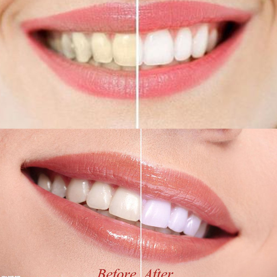 Bamboo Charcoal Teeth Tooth De - огляд і ціна Teeth Whitening Hismile