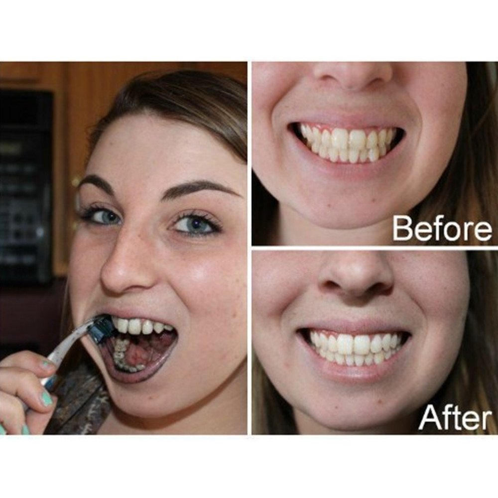 Bamboo Charcoal Teeth Tooth De - огляд і ціна Teeth Whitening Hismile