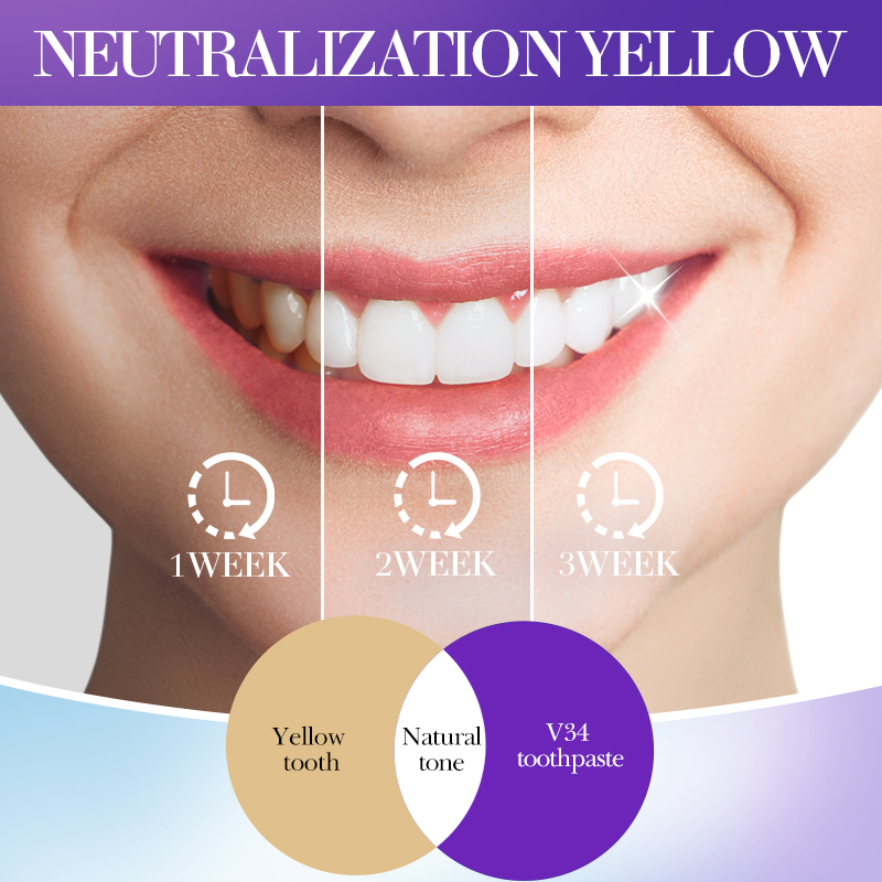 SADOER V34 Toothpaste Stain Re - огляд і ціна Teeth Whitening Hismile