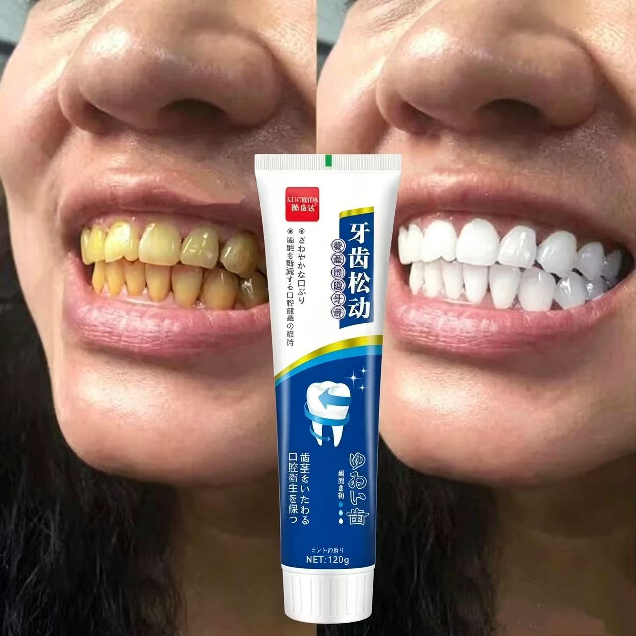 Fix Loose Teeth Japanese Impor - огляд і ціна Teeth Whitening Japanese