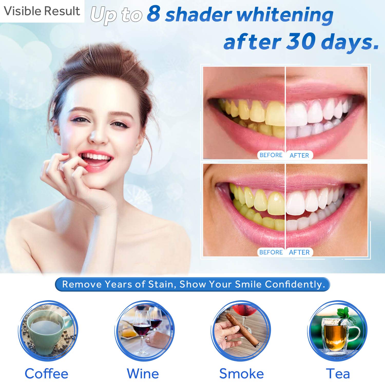 Teeth Whitening Gel Refill Syr - огляд і ціна Teeth Whitening Before And After