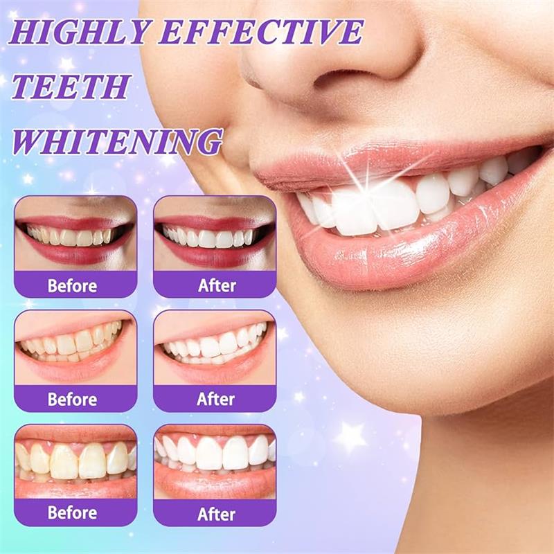 9D Purple Teeth Whitening Toot - огляд і ціна Teeth Whitening That Works