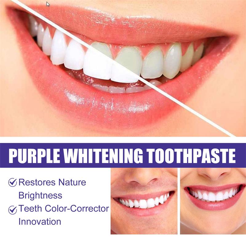 9D Purple Teeth Whitening Toot - огляд і ціна Teeth Whitening That Works