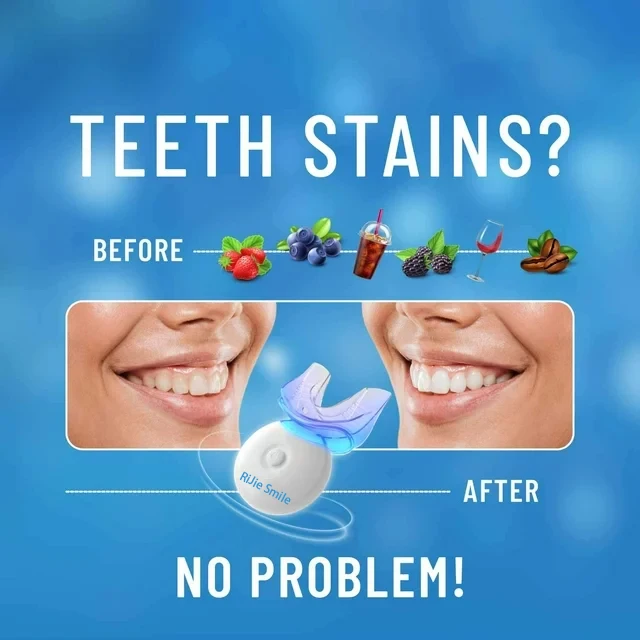 High Quality Cleaning Kit Wire - огляд і ціна Teeth Whitening Kit At Home