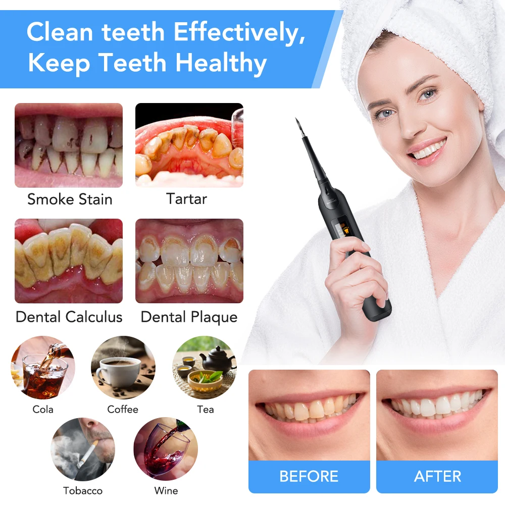 Electric Dental Scaler Toothbr - огляд і ціна Teeth Whitening Toothbrush