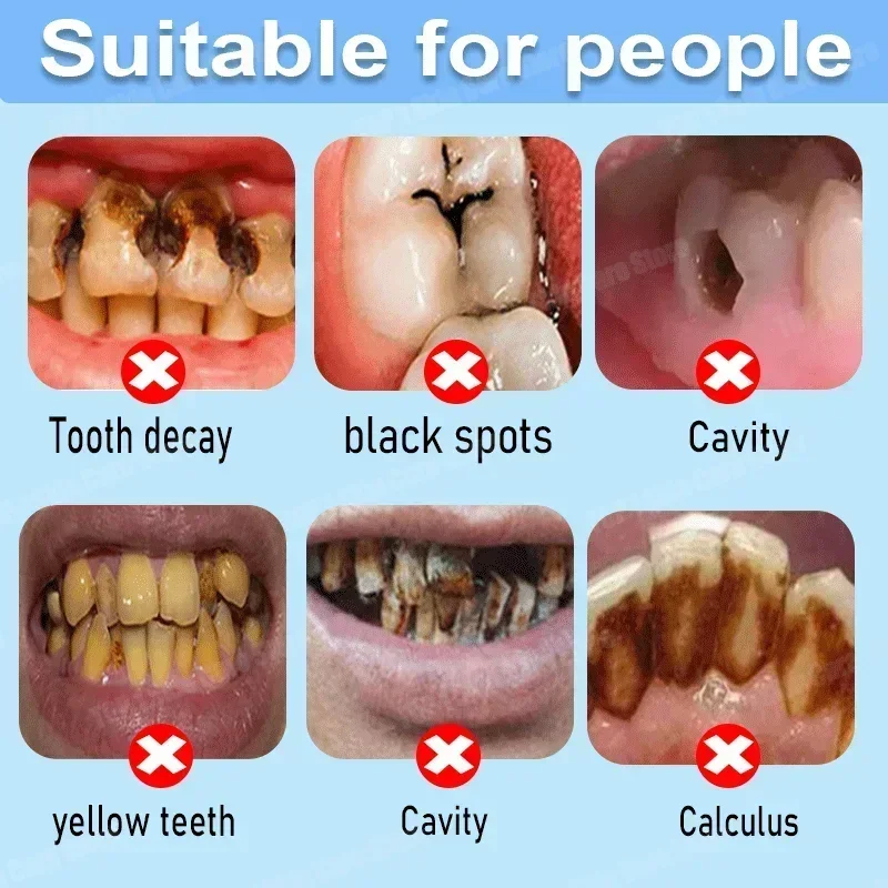 Anti Decay Toothpaste Repairs  - огляд і ціна Teeth Whitening That Works