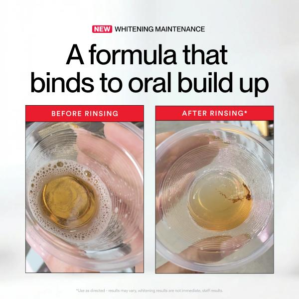 Hismile ID Whitening Stain Mou - огляд і ціна Teeth Whitening Hismile