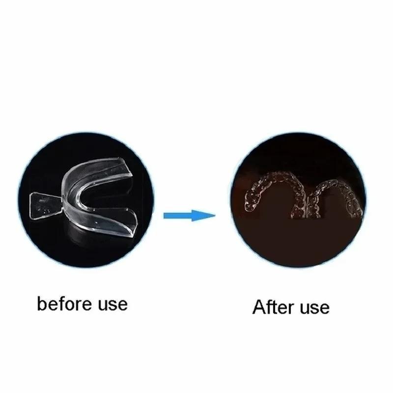 Professional Teeth Whitening T - огляд і ціна Teeth Whitening Kit At Home