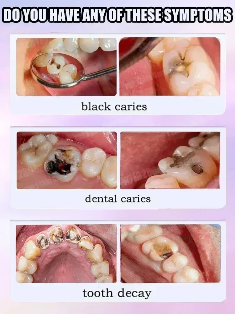 Hot sales Best-selling, Scient - огляд і ціна Teeth Whitening That Works