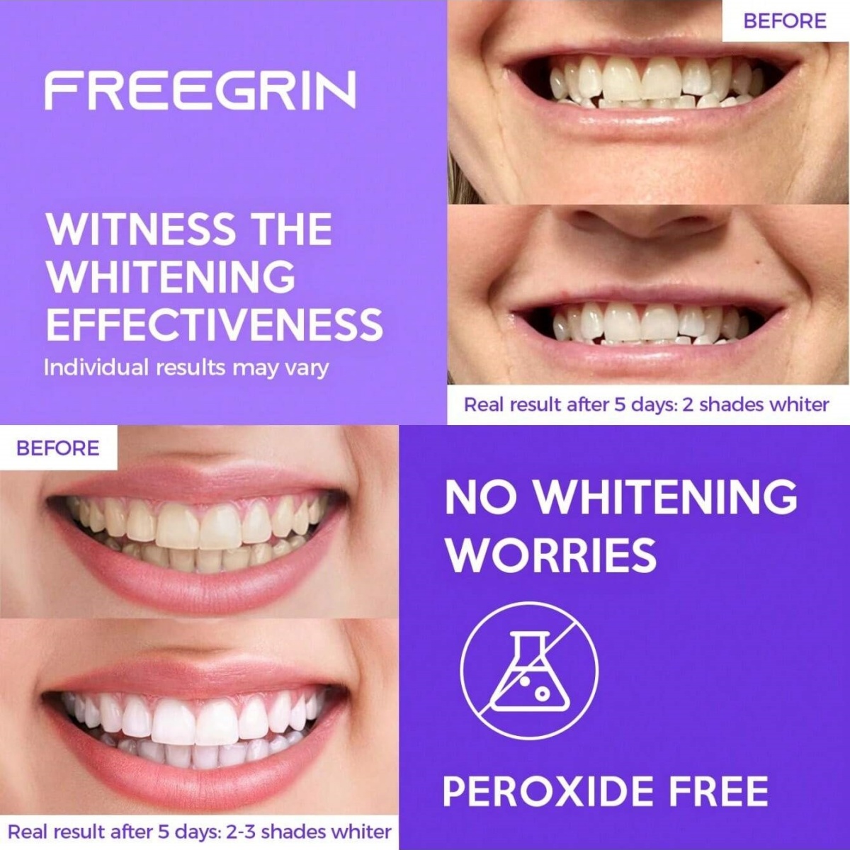 Deluxe Whitening Teeth Sticker - огляд і ціна Teeth Whitening Before And After