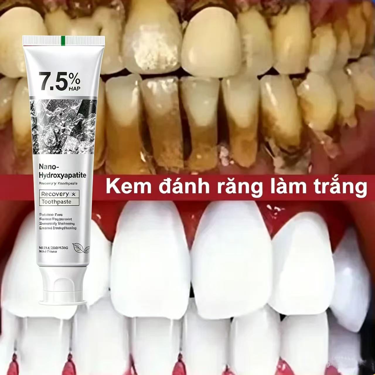7.5% Hydroxyapatite Probiotic  - огляд і ціна Teeth Whitening That Works