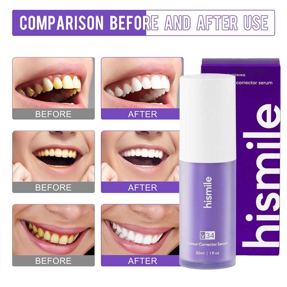 Hismile Purple Toothpaste Teet - огляд і ціна Teeth Whitening Hismile