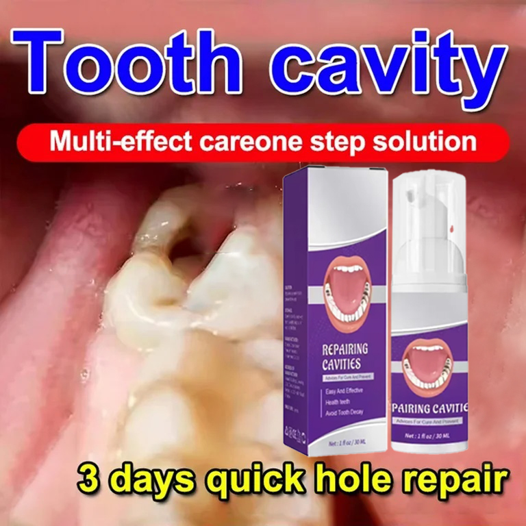 Teeth Cleaning Toothpaste Remo - огляд і ціна Teeth Whitening That Works